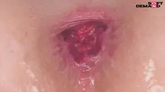 大量の腸汁ダクダクダクダク超キバリイキ ウルトラ連続AtoM ウルトラ大量浣腸 加賀美さら(24) アナル・リバイバルのサムネイル画像